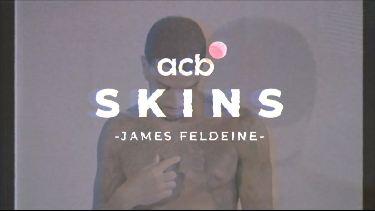 Skins acb: James Feldeine